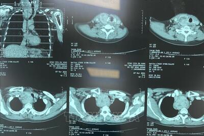 <a href="/tin-tuc" title="Tin tức" rel="dofollow">Tin tức</a>