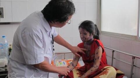 Dịch bệnh thủy đậu đang vào mùa