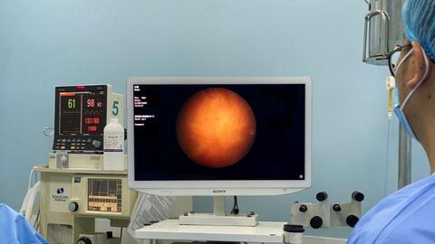 Công nghệ hỗ trợ đắc lực trong điều trị ung thư bàng quang