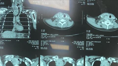 Chẩn đoán hình ảnh không cần phim in vào Quỹ BHYT chi trả