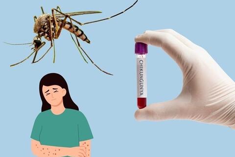 Bộ Y tế bác tin Việt Nam ghi nhận ca mắc bệnh Chikungunya