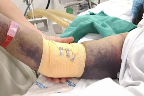 Hà Nội ghi nhận thêm 120 ca sốt xuất huyết tại 67 phường, xã